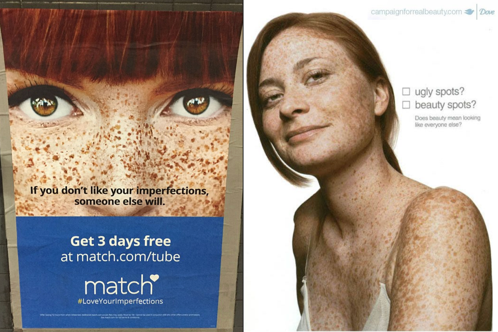 taches de rousseur et femmes