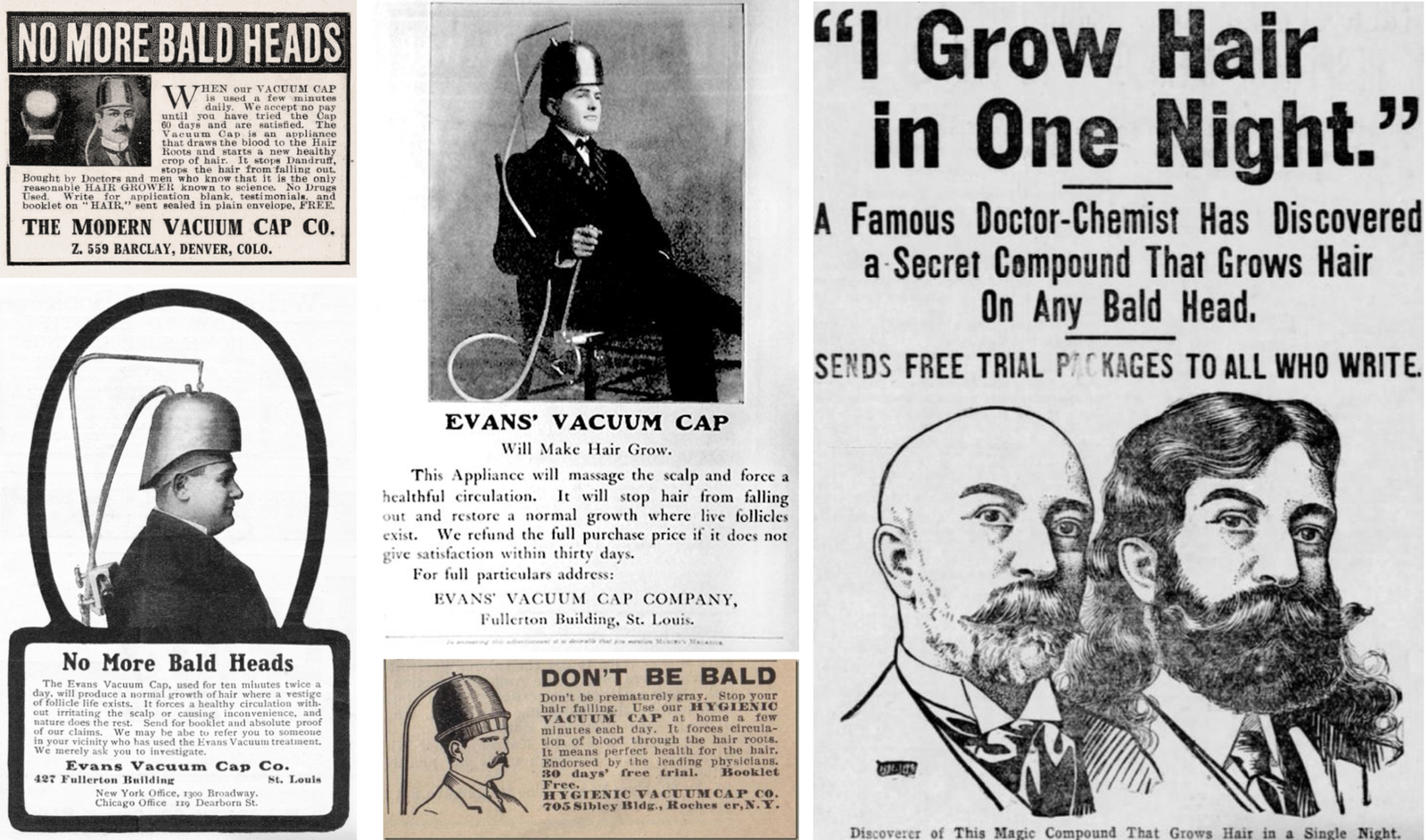 publicités anciennes pour appareils à faire repousser les cheveux